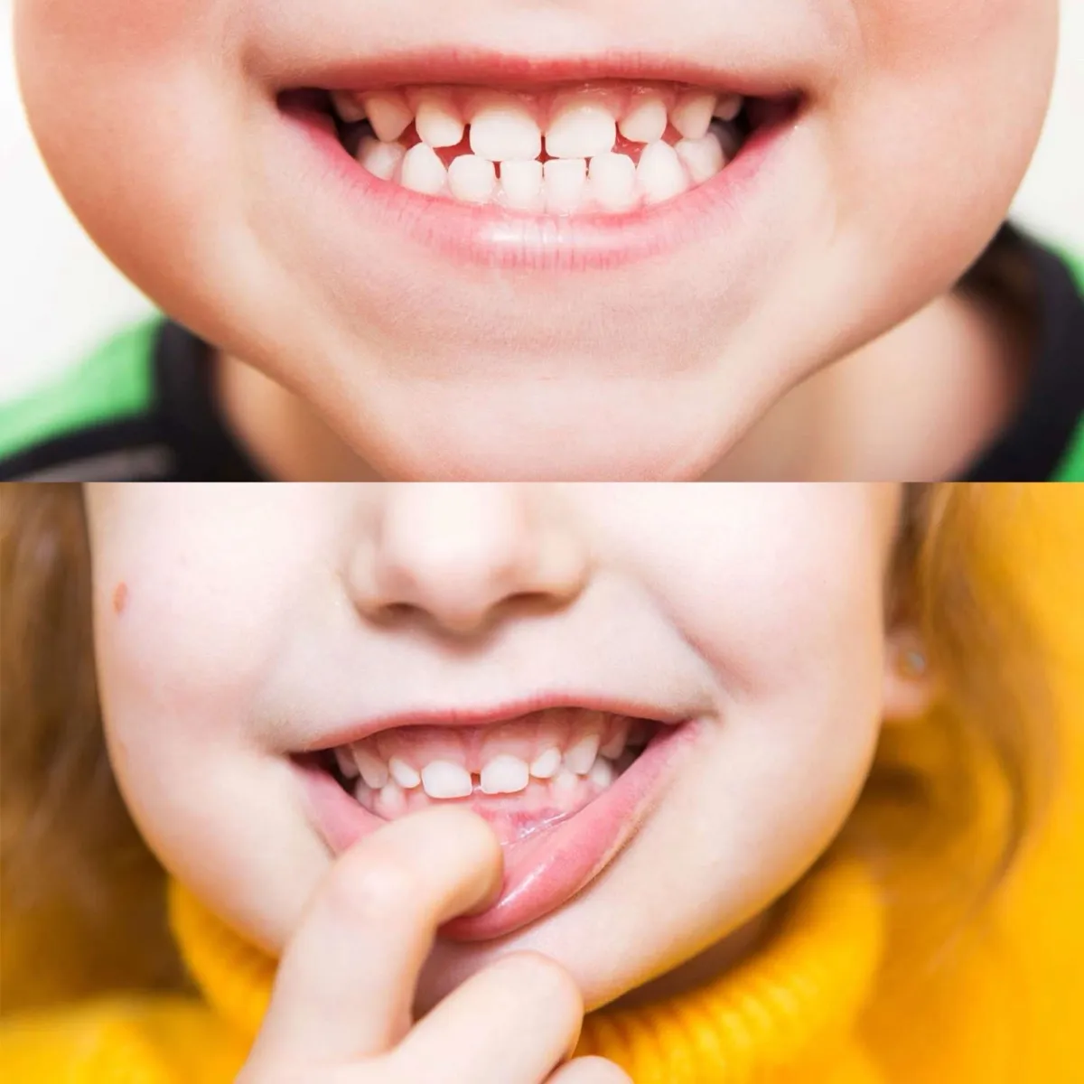 Primer plano de la dentición de un niño, odontopediatría en la Clínica Dental Rita Otero
